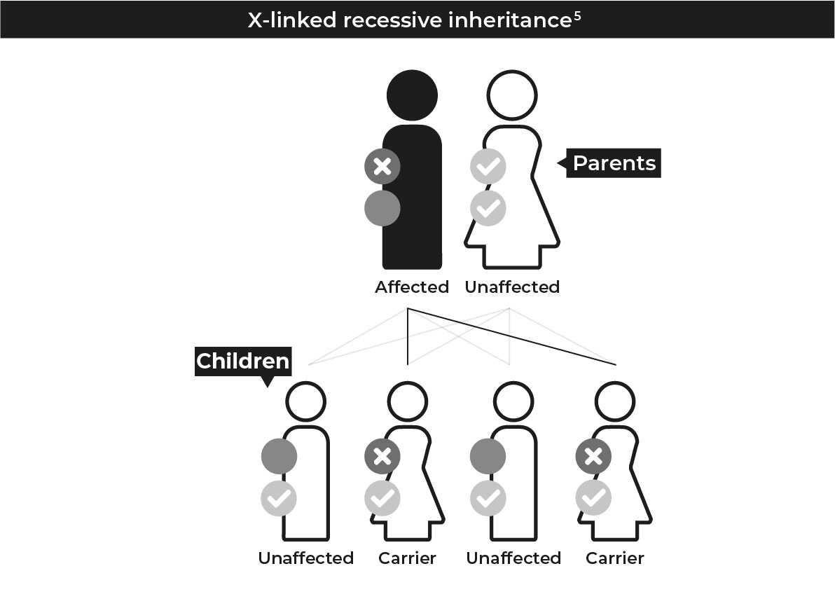A diagram of X-linked recessive inheritance. An affected father who has one copy of the mutation on his X chromosome and a mother who has two normal versions of the gene on her X chromosomes. They have four children, two sons who are unaffected and have inherited the normal x chromosome from their mother and two daughters who are carriers and have one normal version of the gene and one copy of the mutation each.