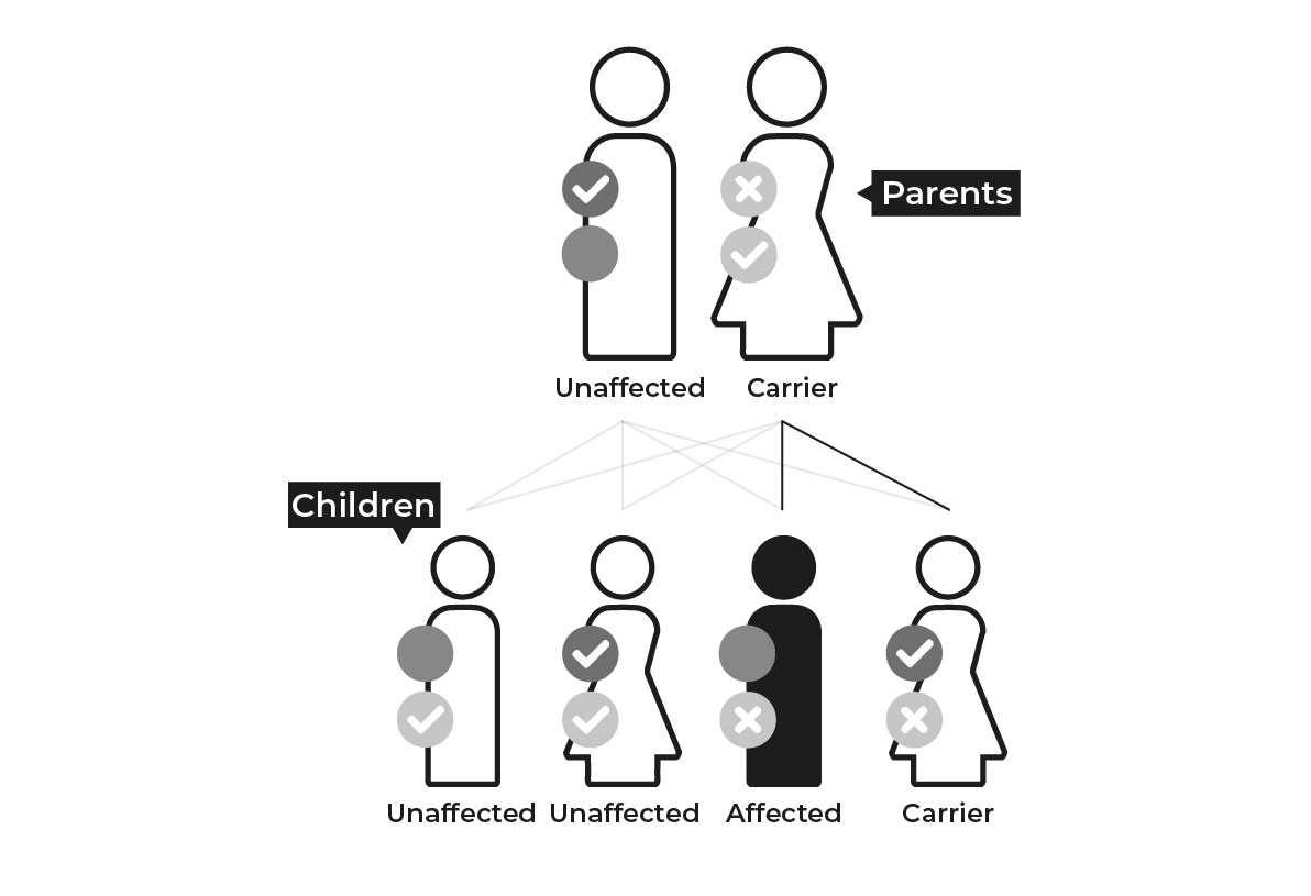A diagram of X-linked recessive inheritance: An unaffected father who has one normal copy of the gene on his X chromosome and a carrier mother who has one normal copy of the gene and one copy of the mutation. They have four children, one unaffected son and one unaffected daughter who have inherited normal copies of the gene. One affected son who has inherited the mutated gene on the X chromosome from his mother, and one daughter who has inherited a normal copy of the gene from her father and a copy of the m