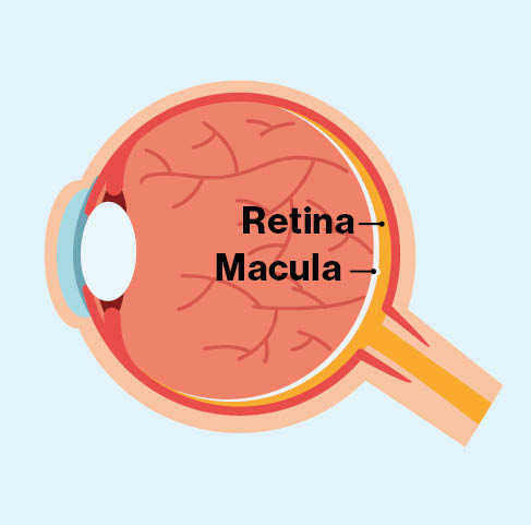 A diagram of the inside of an eye with the retina and macula labelled