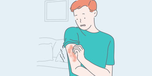 Man scratching his right arm